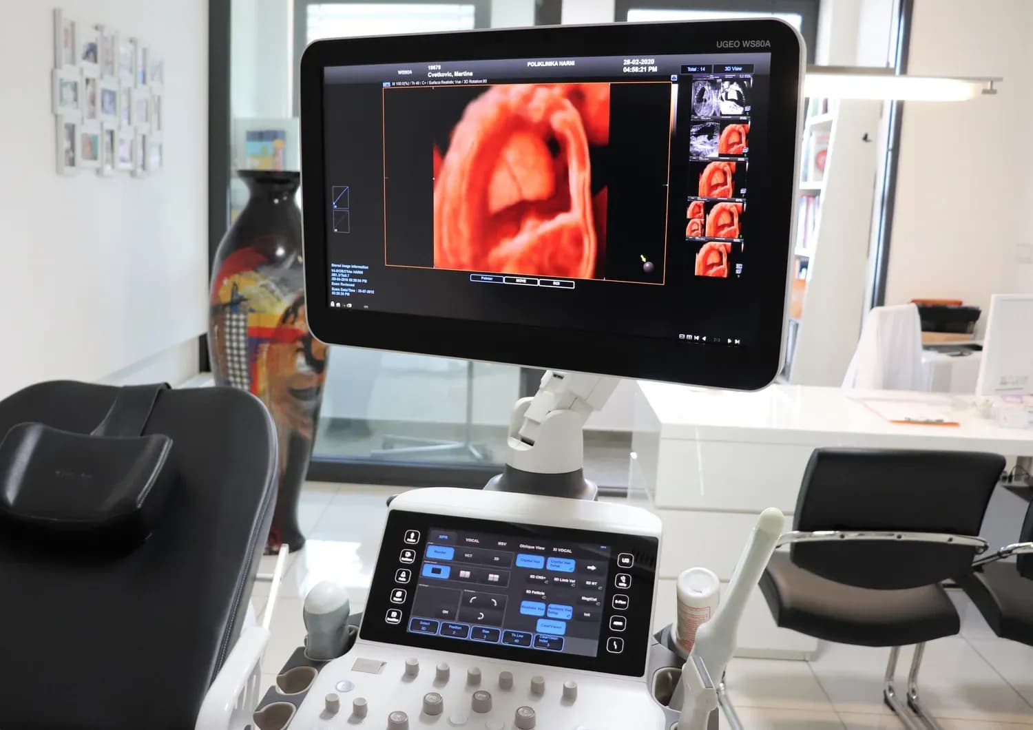 Ginekološki ultrazvučni uređaj u Poliklinici Harni.