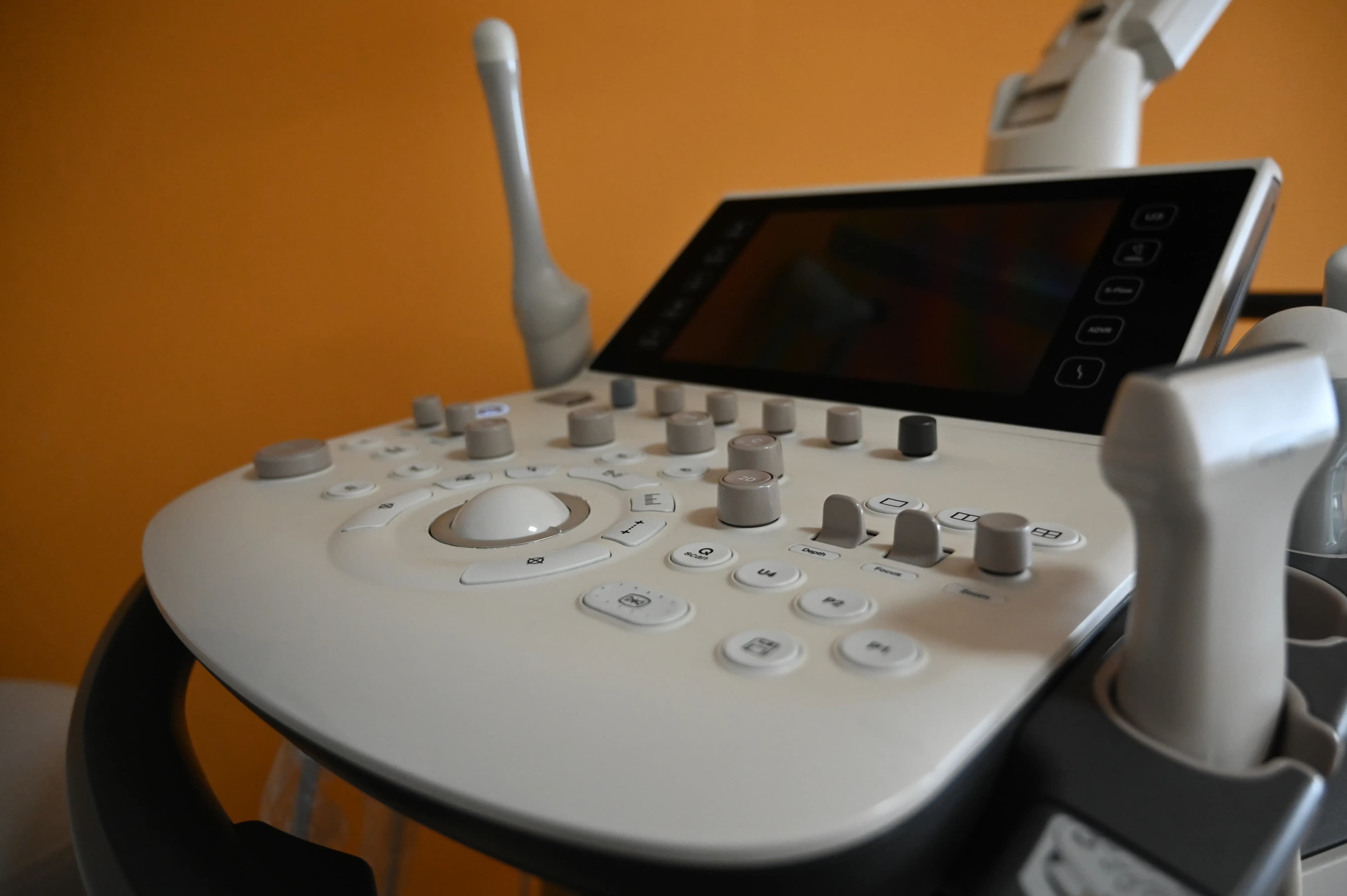 Ginekološki ultrazvučni uređaj u Poliklinici Harni.