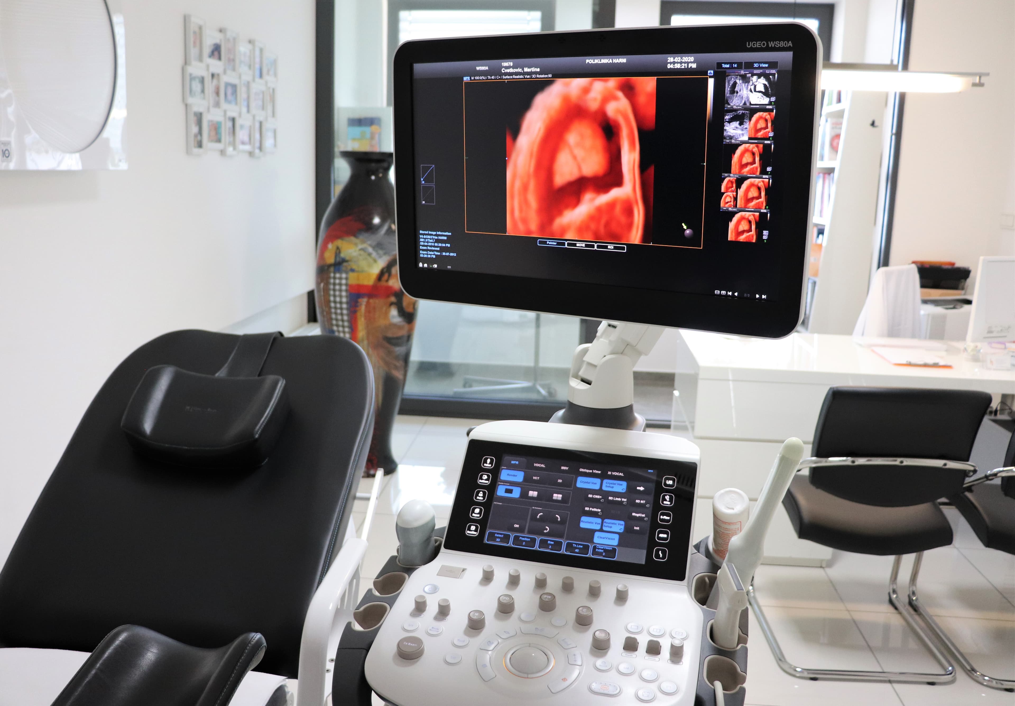 Ultrazvučna dijagnostika