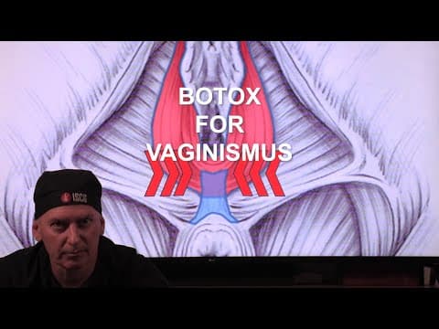 Vaginizam i botulinski toksin