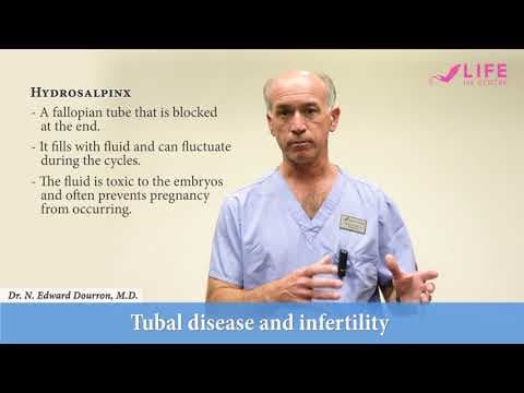 Salpingitis i hidrosalpinks – upala jajovoda, PID i neplodnost