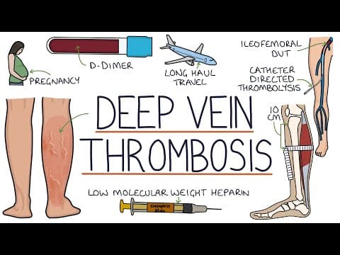 Tromboza i hormonska kontracepcija