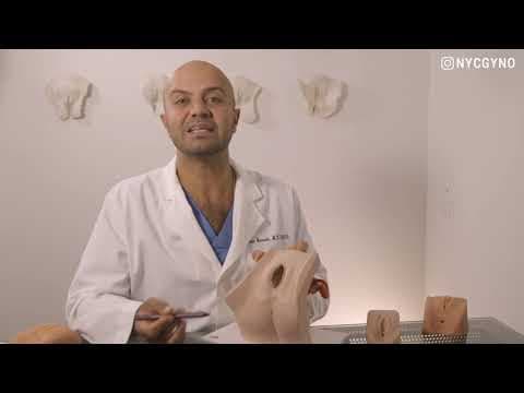 Kombinacija lasera, PRP-a i filera